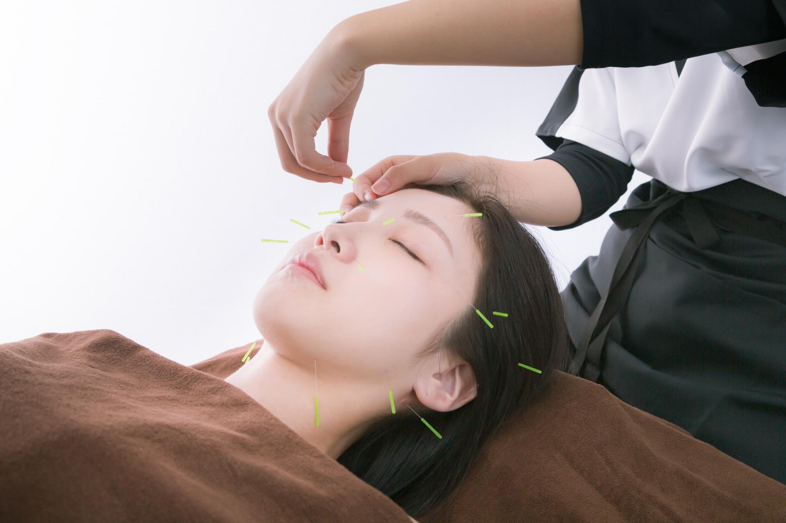 青山の人気美容鍼サロンおすすめ7選！料金・特徴・口コミを徹底比較【2026年最新】