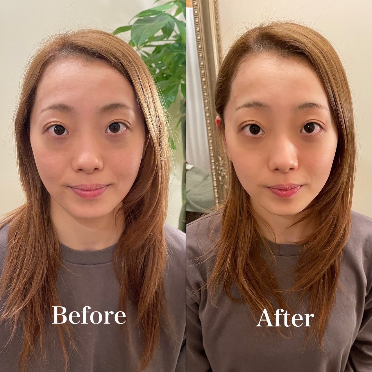美容鍼と整体を6回受けたモニターの方の施術前後の顔写真（女性）