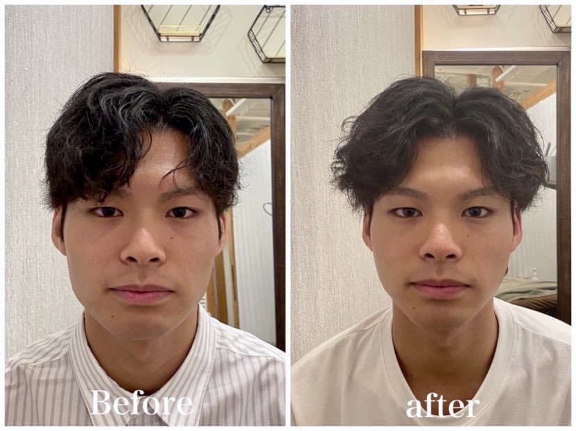 美容鍼と整体を6回受けたモニターの方の施術前後の顔写真（男性）
